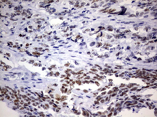 m06669 anti nab1 mouse monoclonal antibody clone id oti1d2 ihc testing 3
