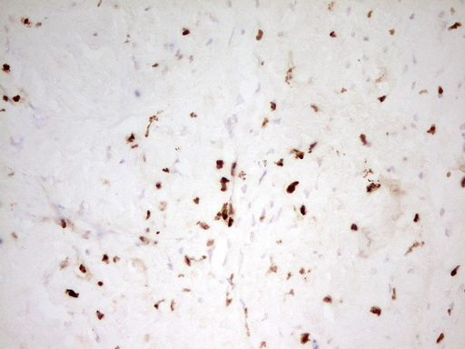 m06675 anti mnda mouse monoclonal antibody clone id oti4h6 ihc testing 10