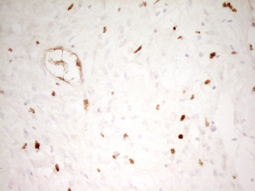 Immunohistochemical staining of paraffin-embedded Human Ovary tissue within the normal limits using anti-MNDA mouse monoclonal antibody