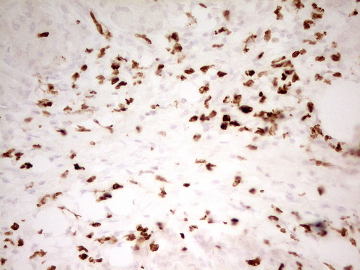 m06675 anti mnda mouse monoclonal antibody clone id oti4h6 ihc testing 4