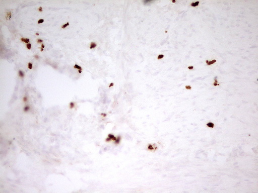 m06675 anti mnda mouse monoclonal antibody clone id oti4h6 ihc testing 5