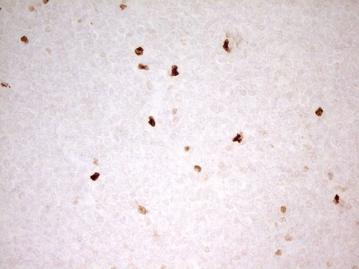 m06675 anti mnda mouse monoclonal antibody clone id oti4h6 ihc testing 6