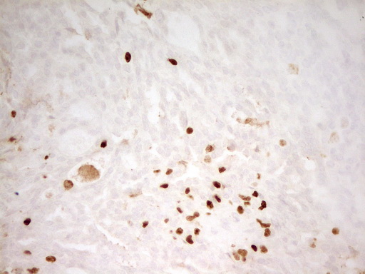 m06675 anti mnda mouse monoclonal antibody clone id oti4h6 ihc testing 7