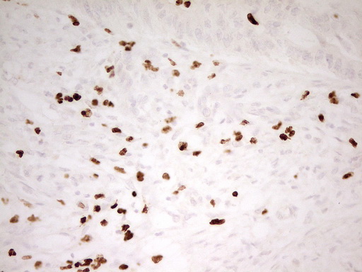 m06675 anti mnda mouse monoclonal antibody clone id oti4h6 ihc testing 8