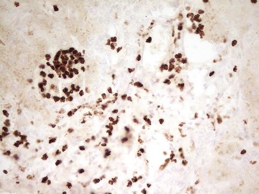 m06675 anti mnda mouse monoclonal antibody clone id oti4h6 ihc testing 9