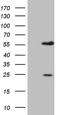 HEK293T cells were transfected with the pCMV6-ENTRY control (Left lane) or pCMV6-ENTRY MNDA (Right lane) cDNA for 48 hrs and lysed