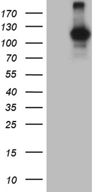 HEK293T cells were transfected with the pCMV6-ENTRY control (Left lane) or pCMV6-ENTRY DGKZ (Right lane) cDNA for 48 hrs and lysed