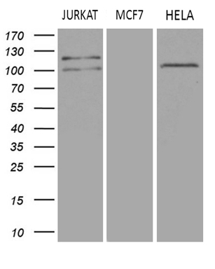 Western blot analysis of extracts (35ug) from 3 different cell lines by using anti-DGKZ monoclonal antibody (1:500)