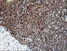 m06683 1 anti pdxk mouse monoclonal antibody clone id oti5h5 ihc testing 4