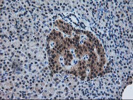 m06683 1 anti pdxk mouse monoclonal antibody clone id oti5h5 ihc testing 5