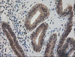 m06683 1 anti pdxk mouse monoclonal antibody clone id oti5h5 ihc testing 7