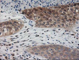 m06683 1 anti pdxk mouse monoclonal antibody clone id oti5h5 ihc testing 8