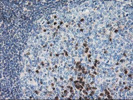 m06683 1 anti pdxk mouse monoclonal antibody clone id oti5h5 ihc testing 9
