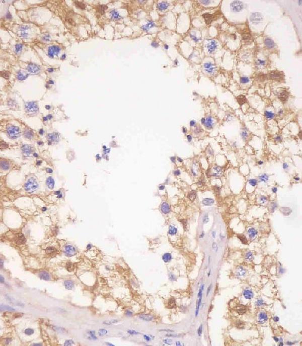 m06683 anti pdxk antibody n term ihc p testing 2