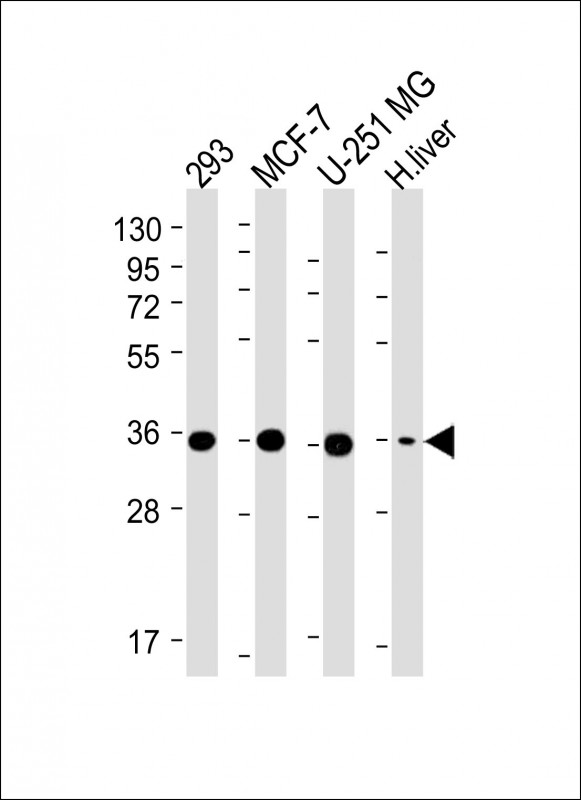 m06683 anti pdxk antibody n term wb testing 1