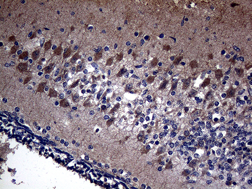 m06684 anti kal1 anos1 mouse monoclonal antibody clone id oti5e10 ihc testing 1