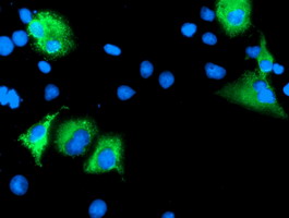 m06697 1 anti lepre1 p3h1 mouse monoclonal antibody clone id oti1b4 if testing 3