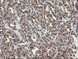 m06697 anti lepre1 p3h1 mouse monoclonal antibody clone id oti1h3 ihc testing 5