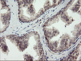m06697 anti lepre1 p3h1 mouse monoclonal antibody clone id oti1h3 ihc testing 7