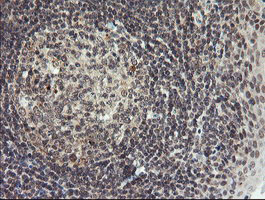 m06697 anti lepre1 p3h1 mouse monoclonal antibody clone id oti1h3 ihc testing 8