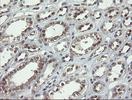 m06697 anti lepre1 p3h1 mouse monoclonal antibody clone id oti1h3 ihc testing 9