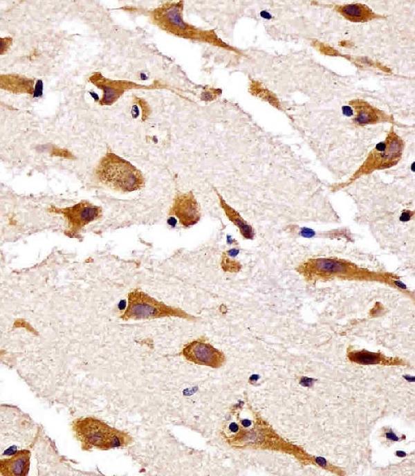 m06699 anti rps27 antibody n term ihc p testing 2