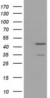 HEK293T cells were transfected with the pCMV6-ENTRY control (Left lane) or pCMV6-ENTRY TTL (Right lane) cDNA for 48 hrs and lysed