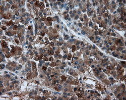 m06712 1 anti bhmt mouse monoclonal antibody clone id oti3e11 ihc testing 4