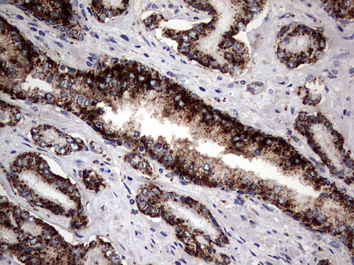 Immunohistochemical staining of paraffin-embedded Human prostate tissue within the normal limits using anti-PDE1A mouse monoclonal antibody