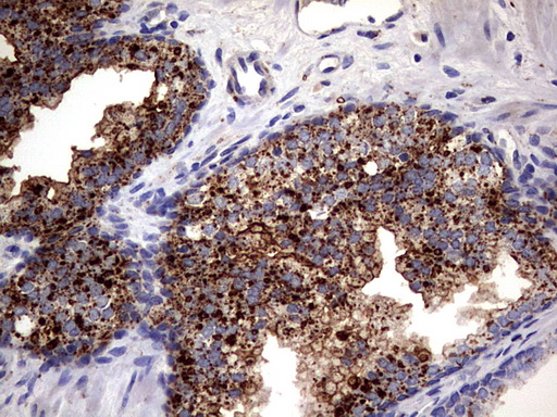 m06723 anti pde1a mouse monoclonal antibody clone id oti7d5 ihc testing 4