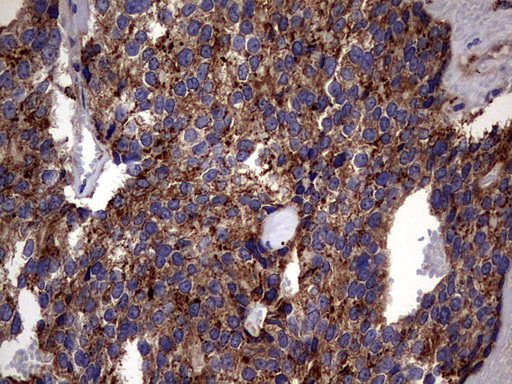 m06723 anti pde1a mouse monoclonal antibody clone id oti7d5 ihc testing 5