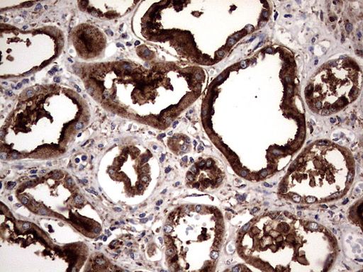 m06723 anti pde1a mouse monoclonal antibody clone id oti7d5 ihc testing 7