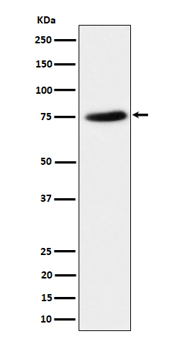Western blot analysis of PPM1G expression in HeLa cell lysate