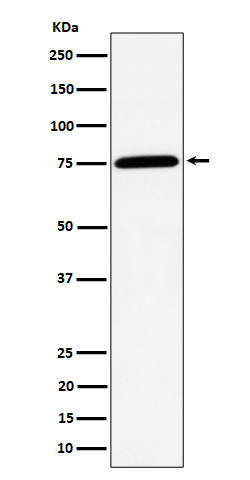 Western blot analysis of PPM1G expression in Jurkat cell lysate