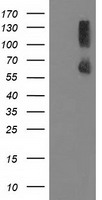 HEK293T cells were transfected with the pCMV6-ENTRY control (Left lane) or pCMV6-ENTRY PPM1G (Right lane) cDNA for 48 hrs and lysed