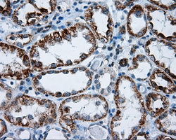 m06726 anti ric8 ric8a mouse monoclonal antibody clone id oti3g3 ihc testing 3