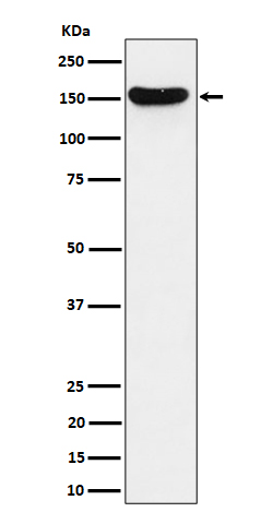 Western blot analysis of HDLBP expression in Jurkat cell lysate