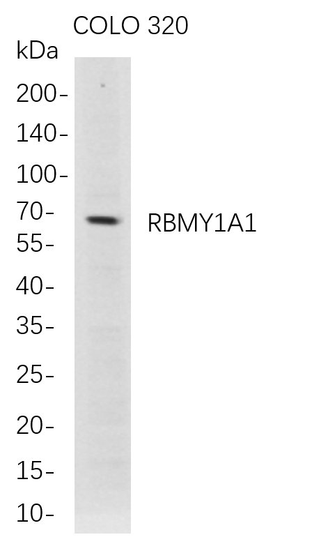 m06728 1 rbmy1a1 primary antibodies wb testing 1
