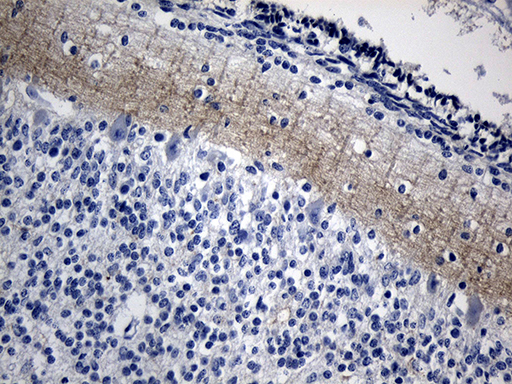 m06730 anti negr1 mouse monoclonal antibody clone id oti3g8 ihc testing 2