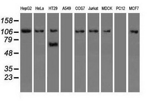 Western blot analysis of extracts (35ug) from 9 different cell lines by using anti-SIGLEC9 monoclonal antibody