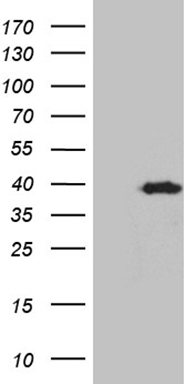 HEK293T cells were transfected with the pCMV6-ENTRY control (Left lane) or pCMV6-ENTRY KLF7 (Right lane) cDNA for 48 hrs and lysed