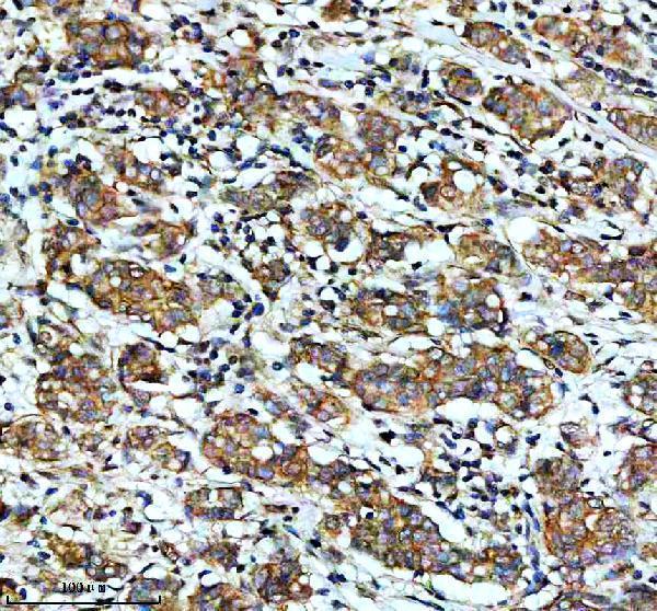 m06774 stk38l primary antibodies ihc testing 1_1