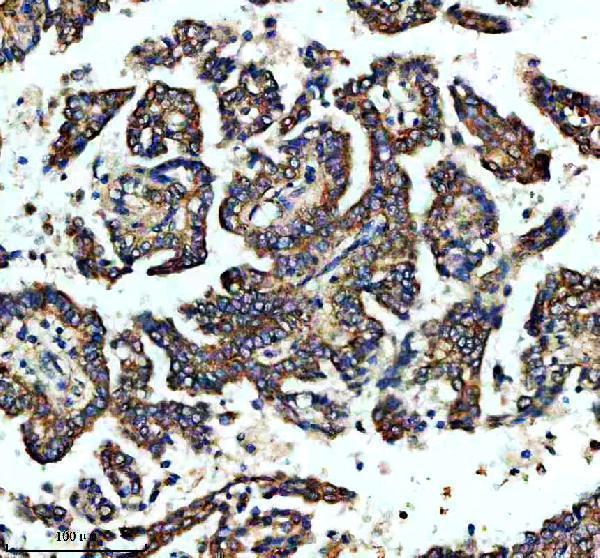m06774 stk38l primary antibodies ihc testing 2_1