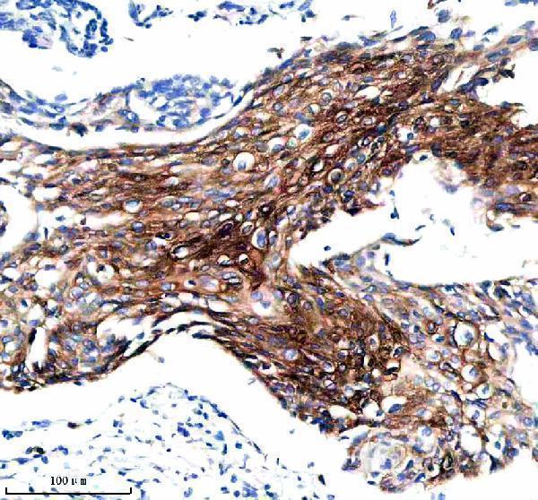 m06791 1 krt15 primary antibodies ihc testing 1_1