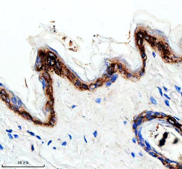m06791 1 krt15 primary antibodies ihc testing 3_1