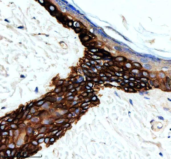 m06791 1 krt15 primary antibodies ihc testing 4_1