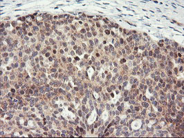 m06794 anti psma4 mouse monoclonal antibody clone id oti1h10 ihc testing 3