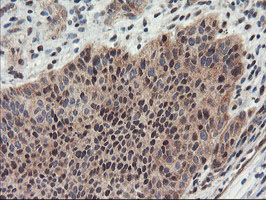 m06794 anti psma4 mouse monoclonal antibody clone id oti1h10 ihc testing 7