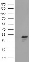 HEK293T cells were transfected with the pCMV6-ENTRY control (Left lane) or pCMV6-ENTRY RASD2 (Right lane) cDNA for 48 hrs and lysed