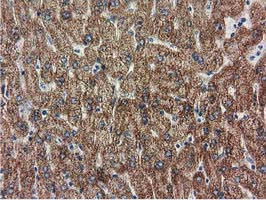 m06806 anti rasd2 mouse monoclonal antibody clone id oti1g1 ihc testing 10